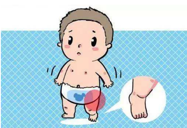 合肥东南骨科医院与你聊聊小孩步态跛行是怎么回事？